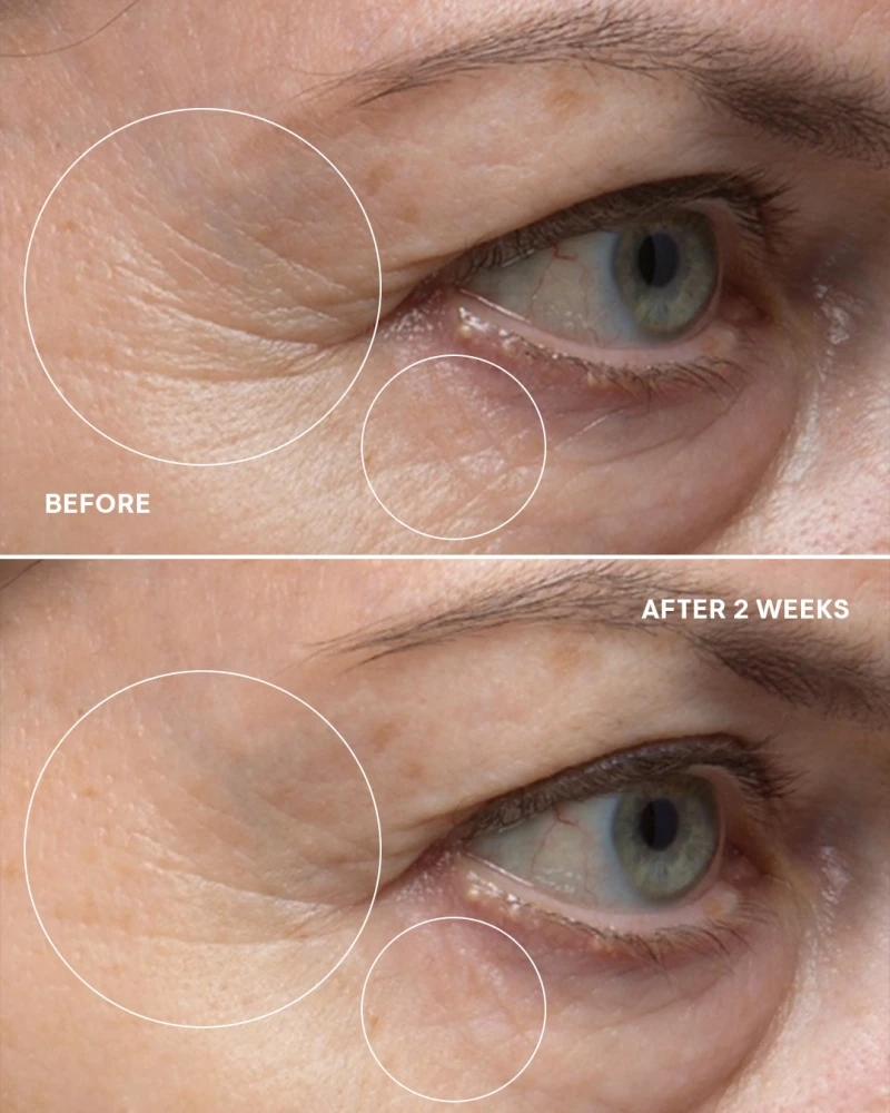 ELEMIS - Мультифункціональна маска від зморшок навколо очей Pro-Collagen Eye Revive Mask - Зображення 3