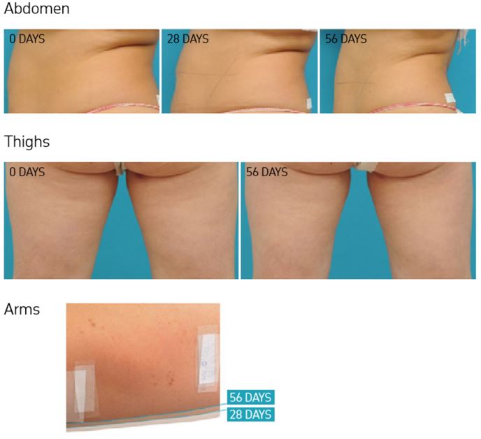 Endor - Моделюючий крем для зменшення жирових відкладень Firming &amp; Body Shaping Cream - Зображення 3